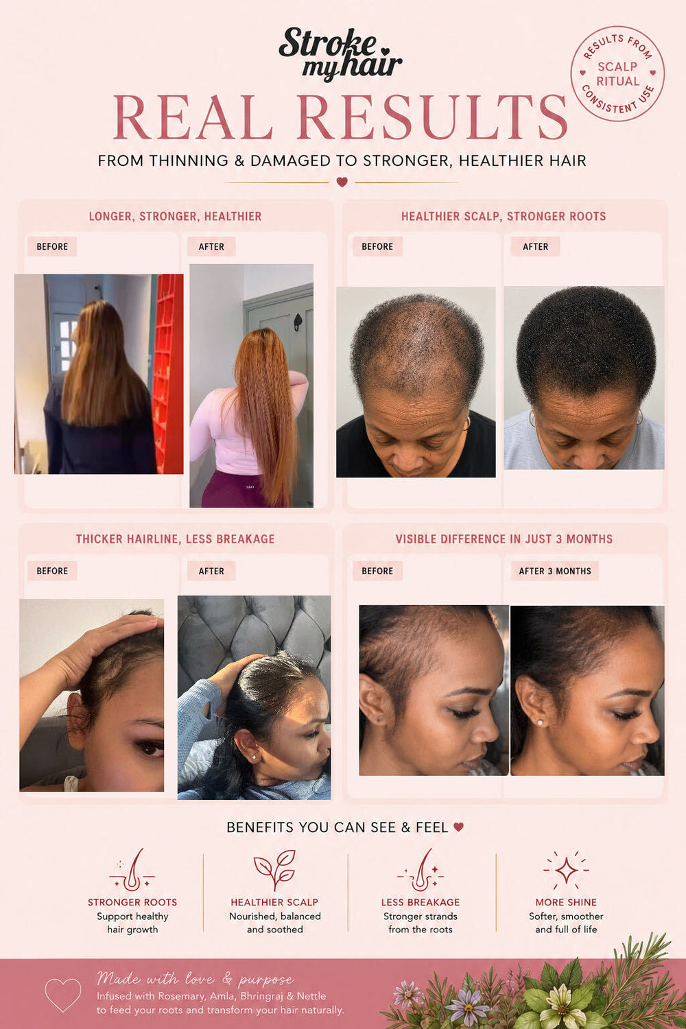 Scalp Ritual | Botanical Pre-Wash Scalp Oil